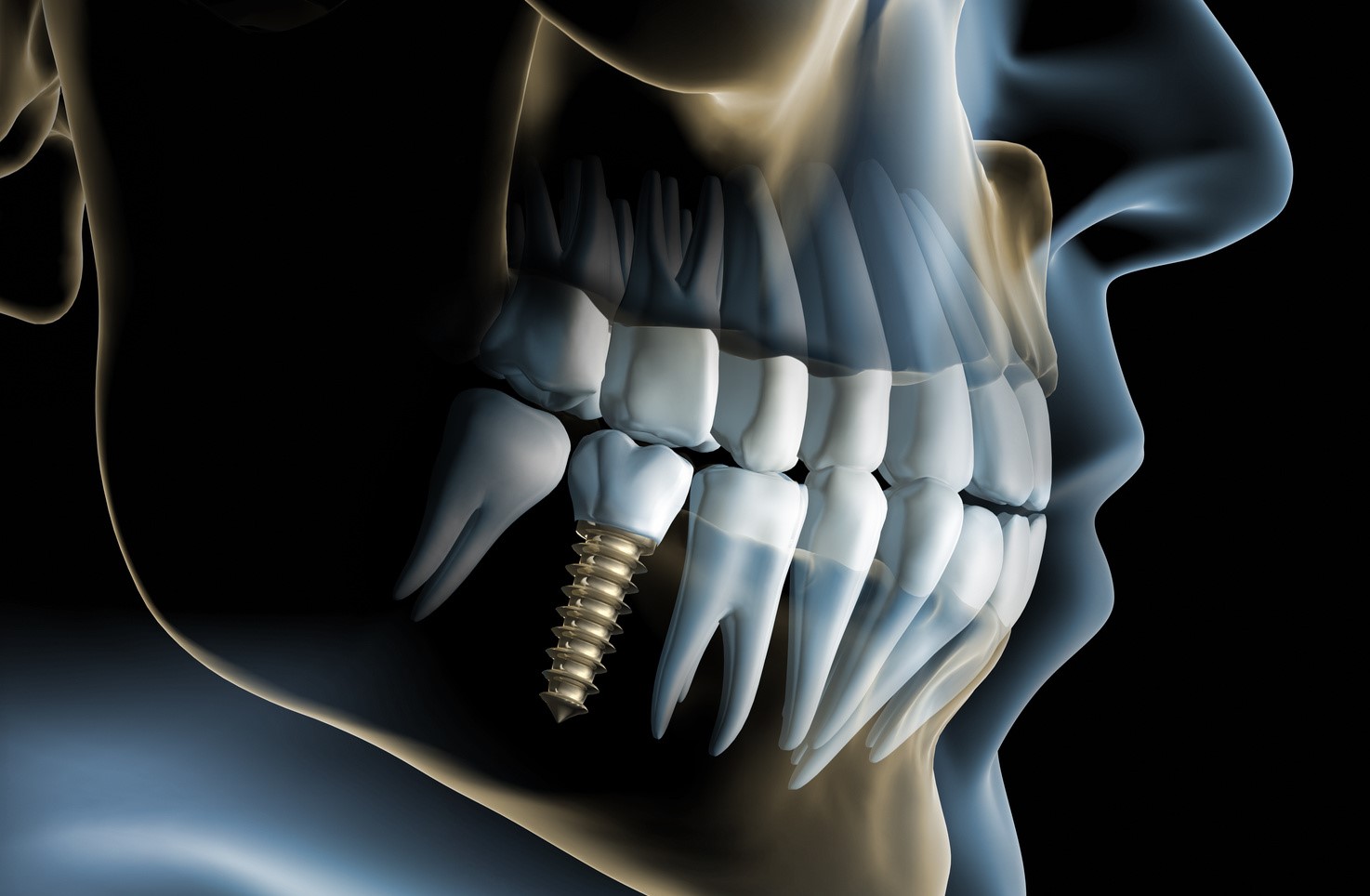 oral surgery scan